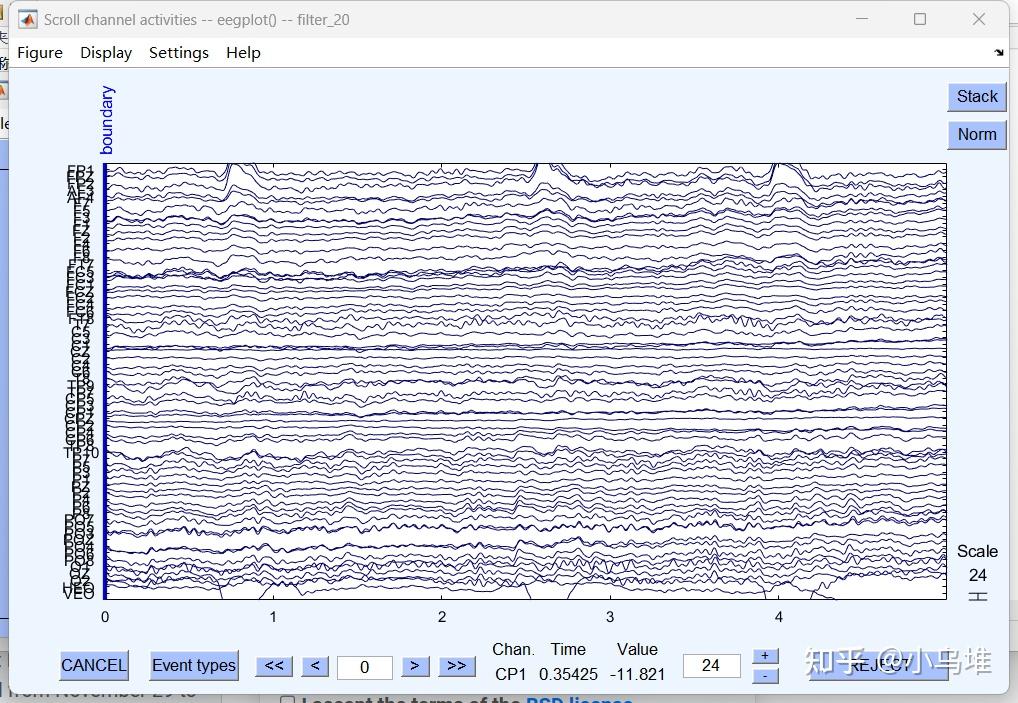 MATLAB医学信号处理2 （eeglab的保姆级教程） 知乎