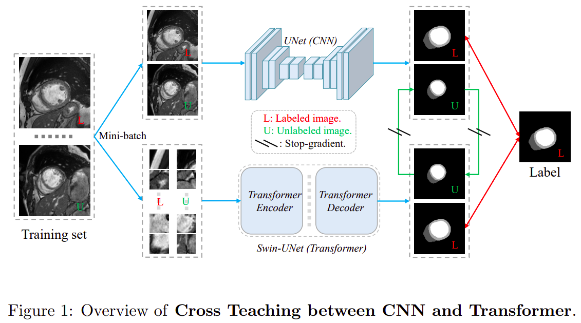 【arXiv:2112】基于CNN与变压器交叉教学的半监督医学图像分割 - 知乎