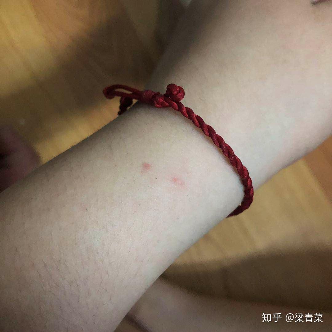 穷逼养猫日记三没想到是我先打的狗针