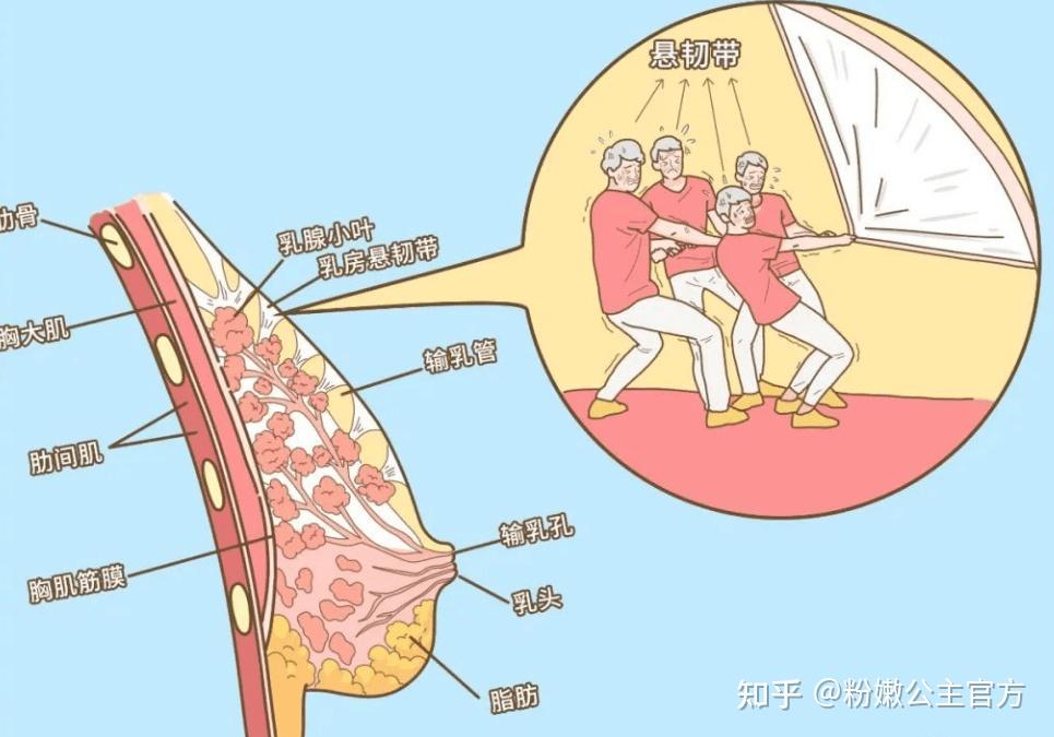 乳房脱垂图片