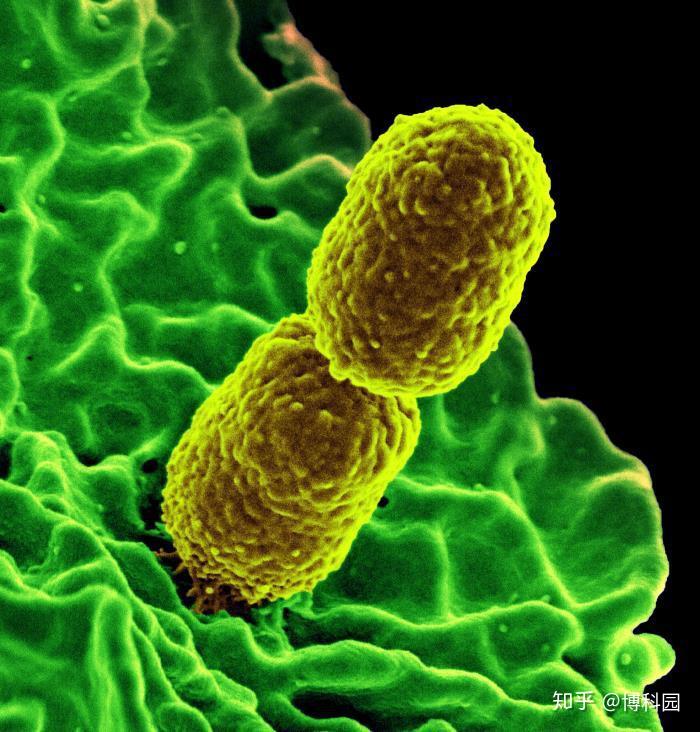 cre是对碳青霉烯类抗生素——碳青霉烯类抗生素的耐药性,cre是对碳