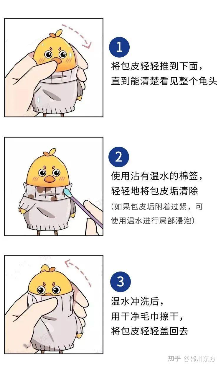 包皮垢多是什么原因?包皮垢不止“脏”那么简单! - 知乎