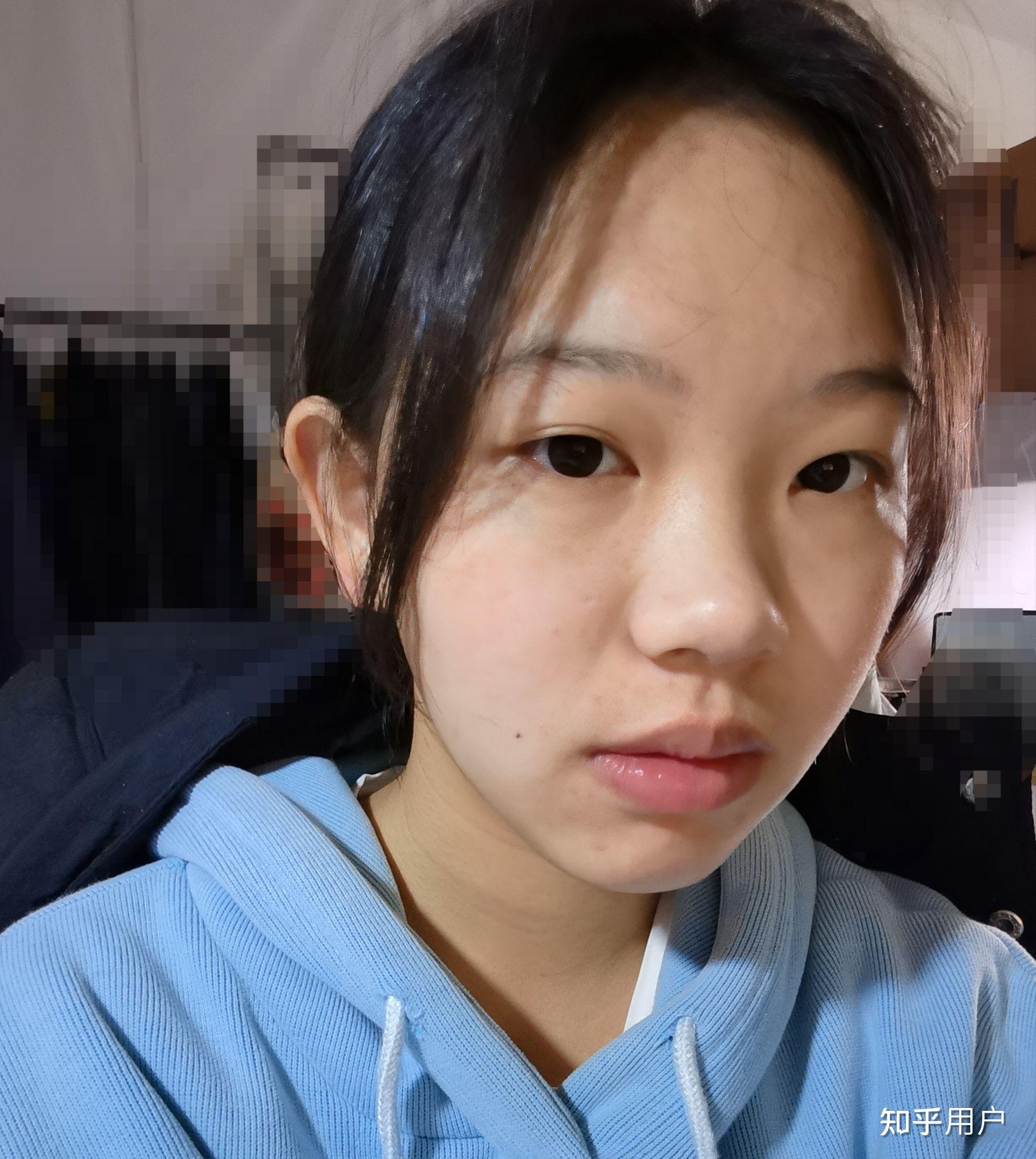 没有鼻梁鼻子塌的人是什么体验