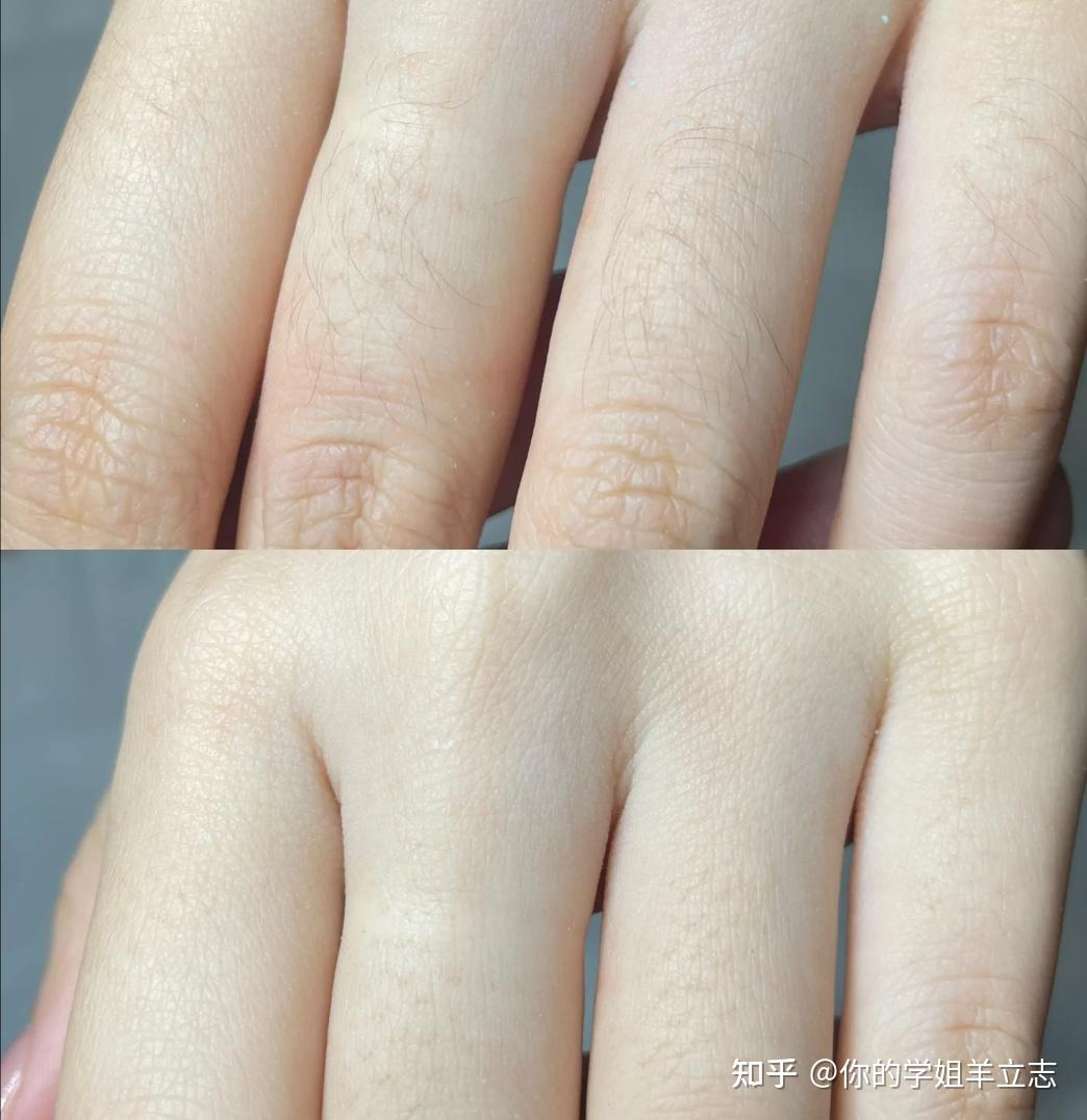 脱毛仪是不是一定要买贵的百元脱毛仪和千元的有什么区别在校大学生更