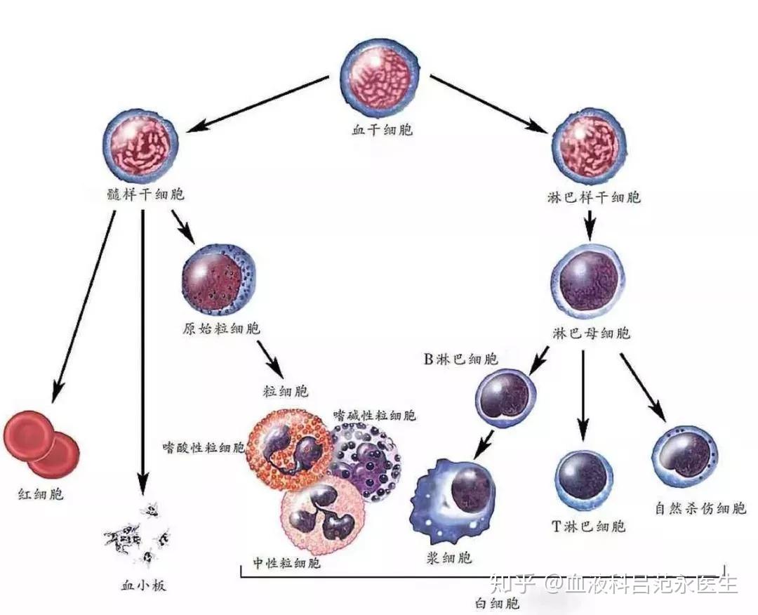 万能的知乎,问几个关于白血病的原始细胞和幼稚细胞问题? 
