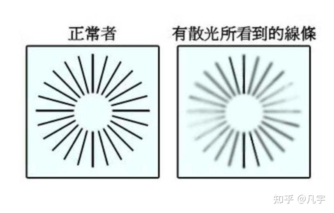 我发现我给绿洲眼镜店忽悠了,说我散光度数上升了很多,结果给我配了幅