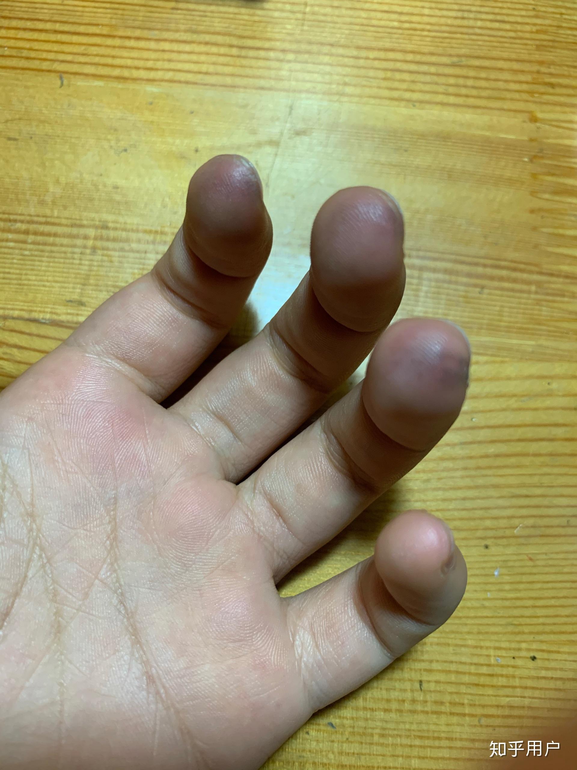 练完小提琴左手手指黑的? - 知乎