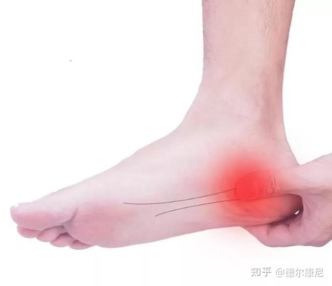 走百病后足底疼痛只需三步轻松康复