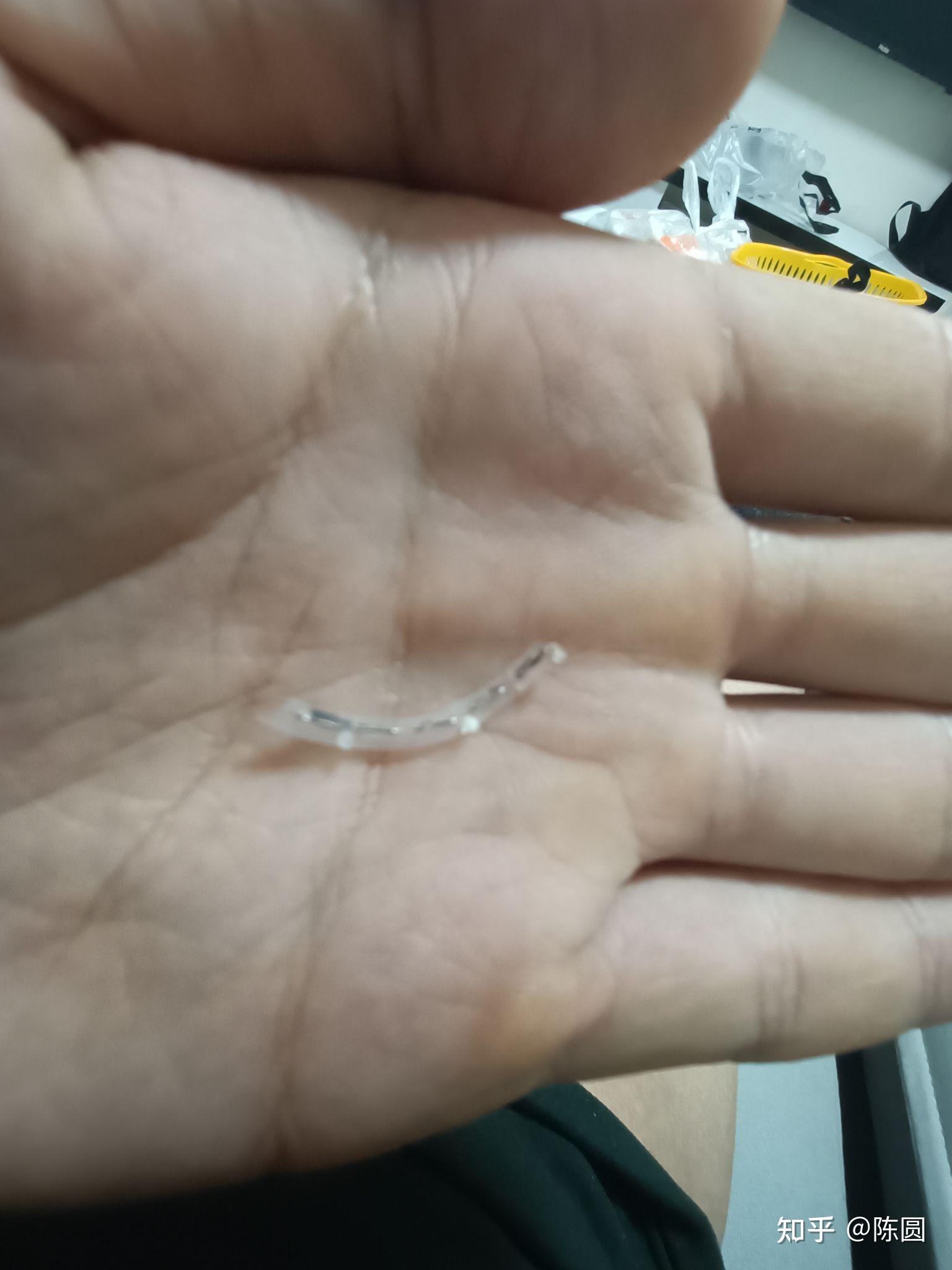 这个就是环切器割完留下的固定伤口的钛钉白色的是胶圈我数了一下一