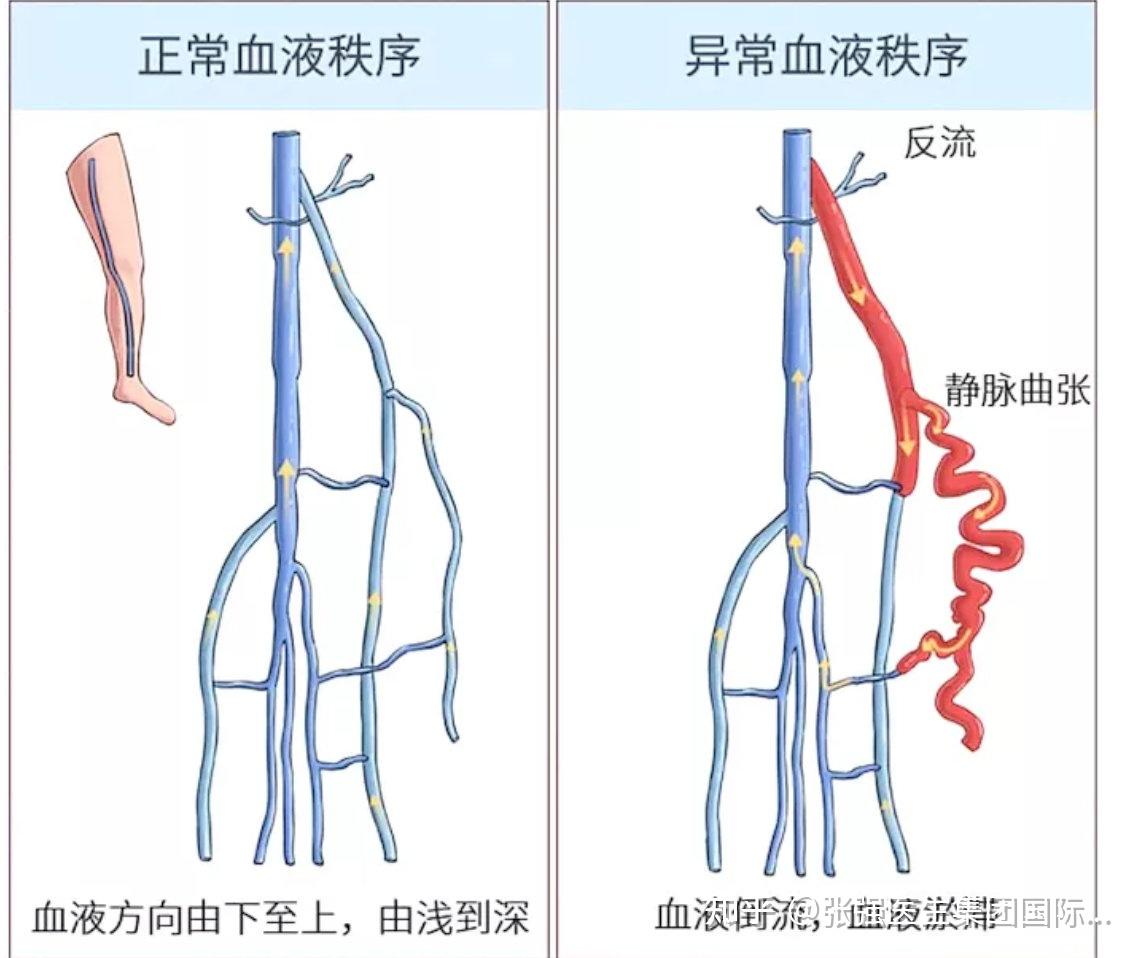 下肢手术消毒范围图解图片