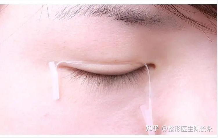 如何辨别自己是内双眼皮,怎么做才能变成双眼皮 - 知乎