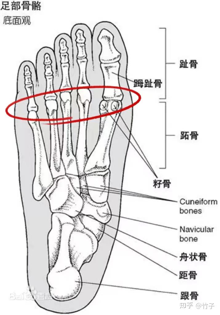 跳绳后跖趾关节疼得慌?可能是因为你没选对鞋!(附跳绳鞋选购指南)