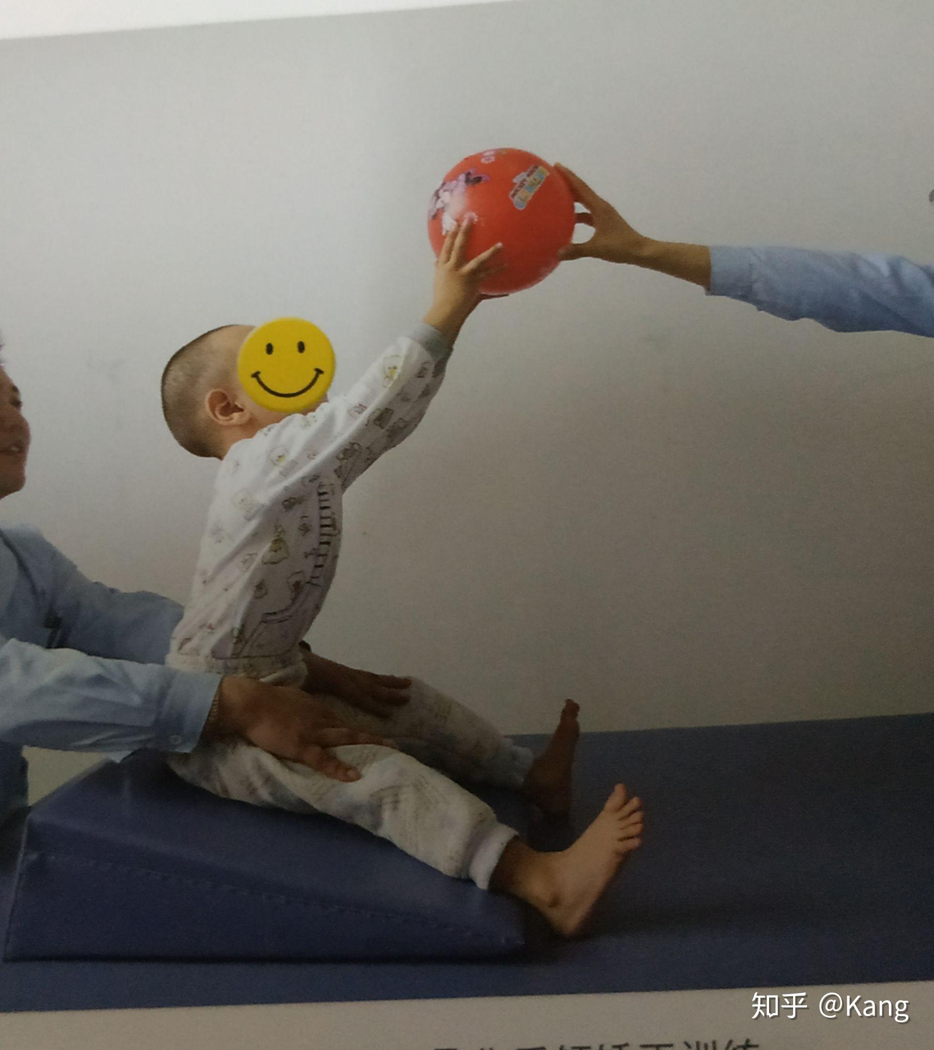 婴幼儿独坐障碍的评估与康复