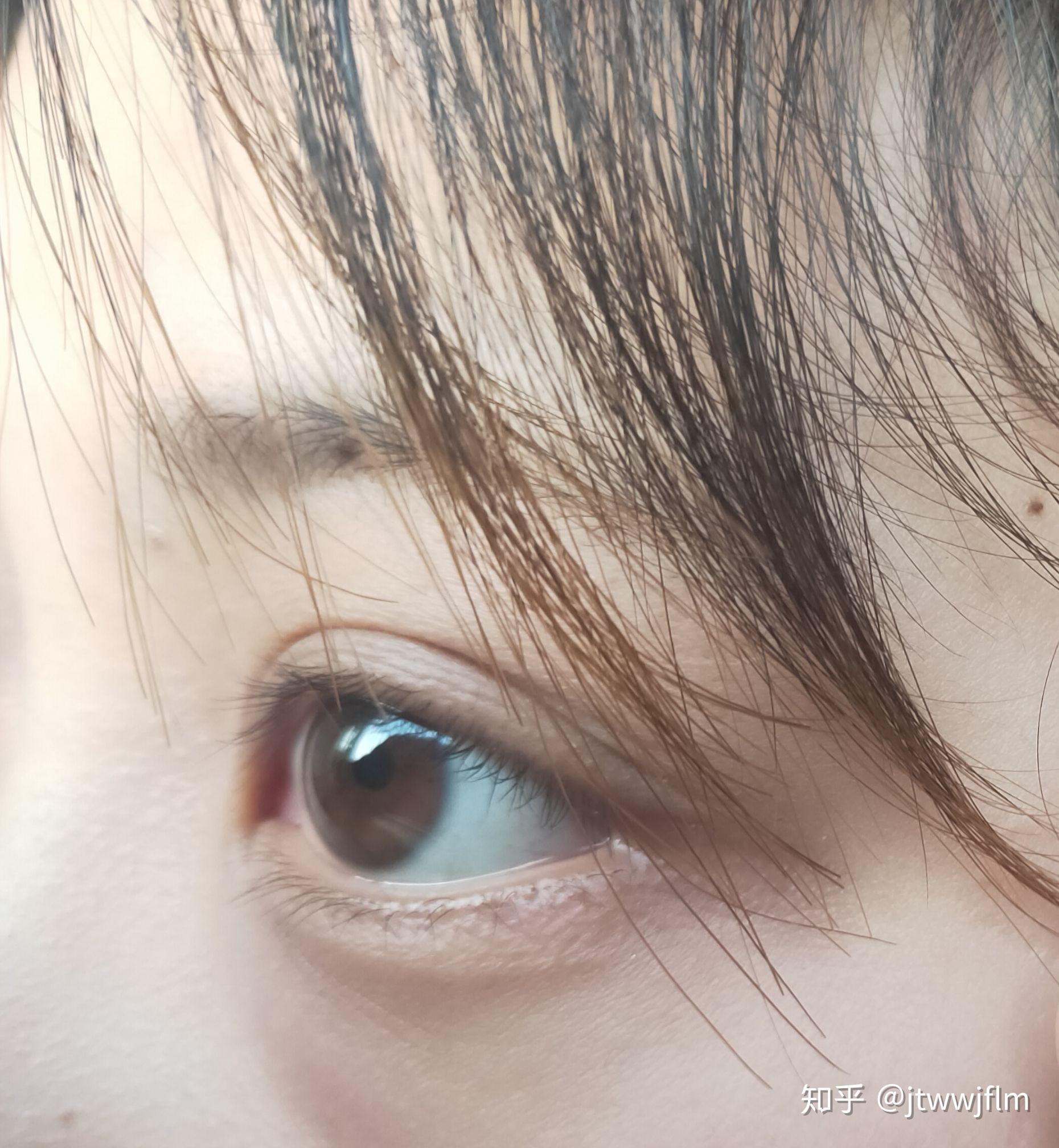 为什么我的眼白会是蓝色,天生就是这样?