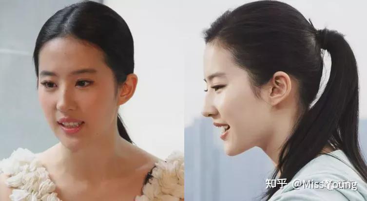 请问各位,我的额头后倾,侧面看像个坡,有没有朋友知道3d打印人工骨垫