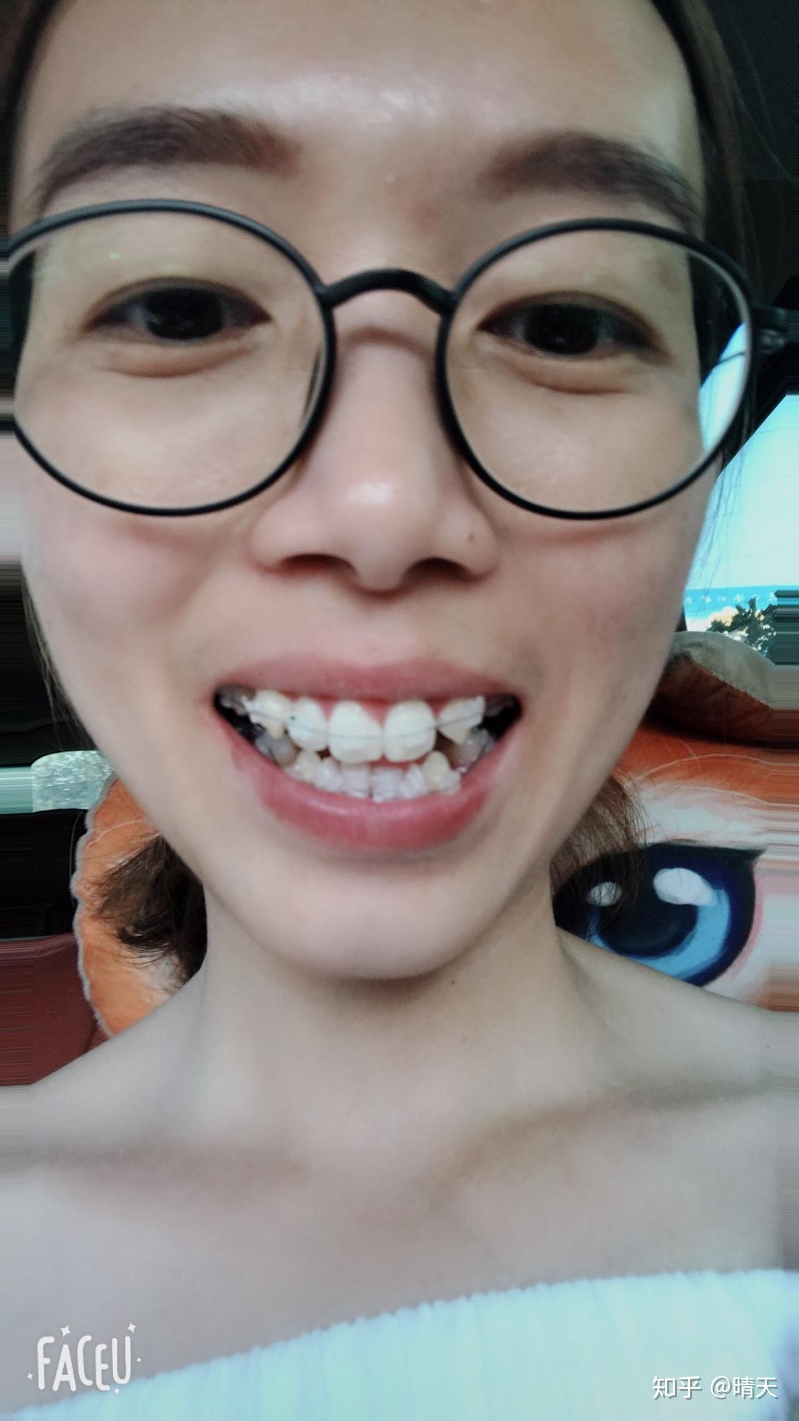 人有几颗上牙 v2-d07631a959e2bd22ba5cbeaede28acb8_r.jpg