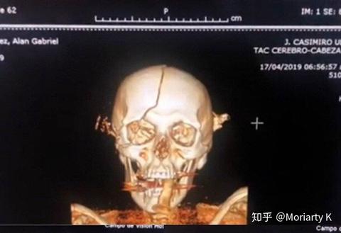 图标