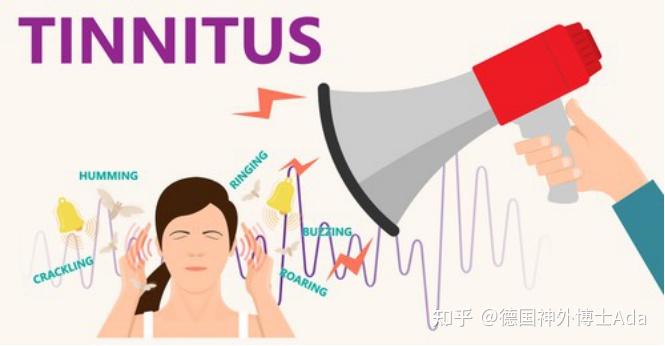 听神经瘤9大症状、5大分型，要手术、放疗还是观察？中外指南怎么说？ - 知乎