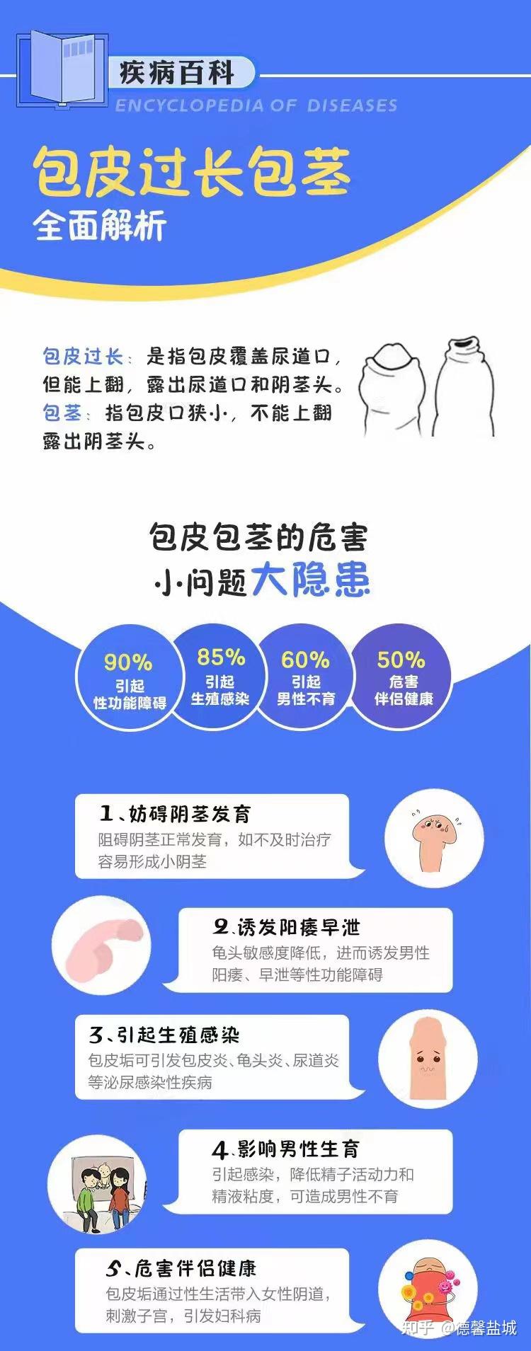 全面解析 包皮过长包茎 - 知乎