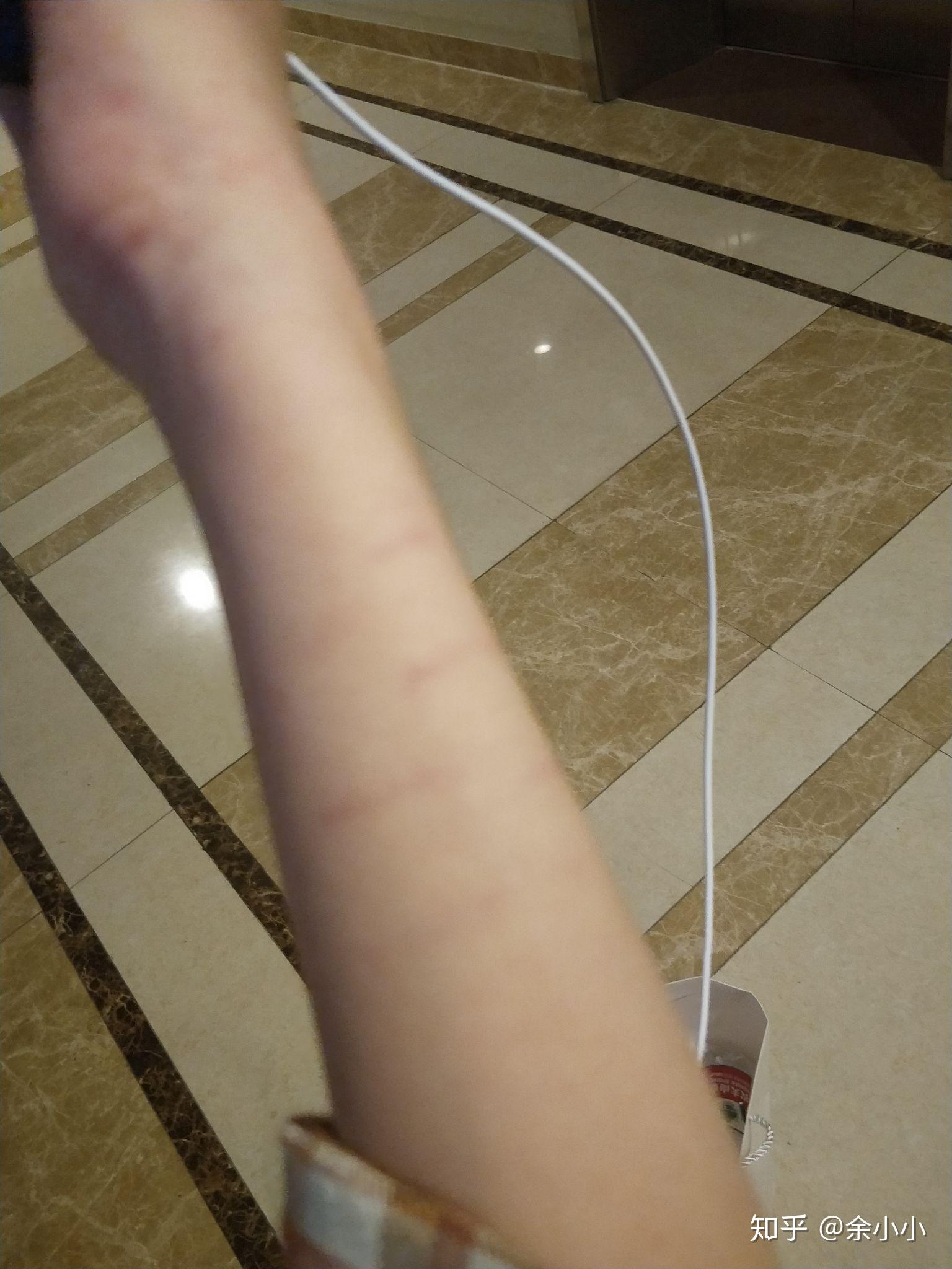 男朋友有抑郁症怎么办