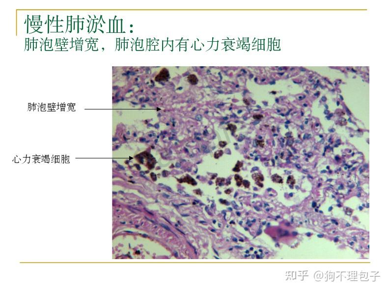 病理切片学习