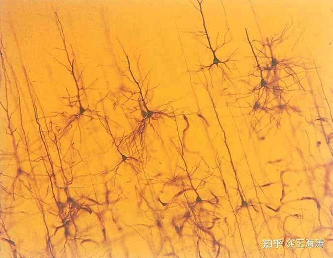 神经元光镜结构图图片