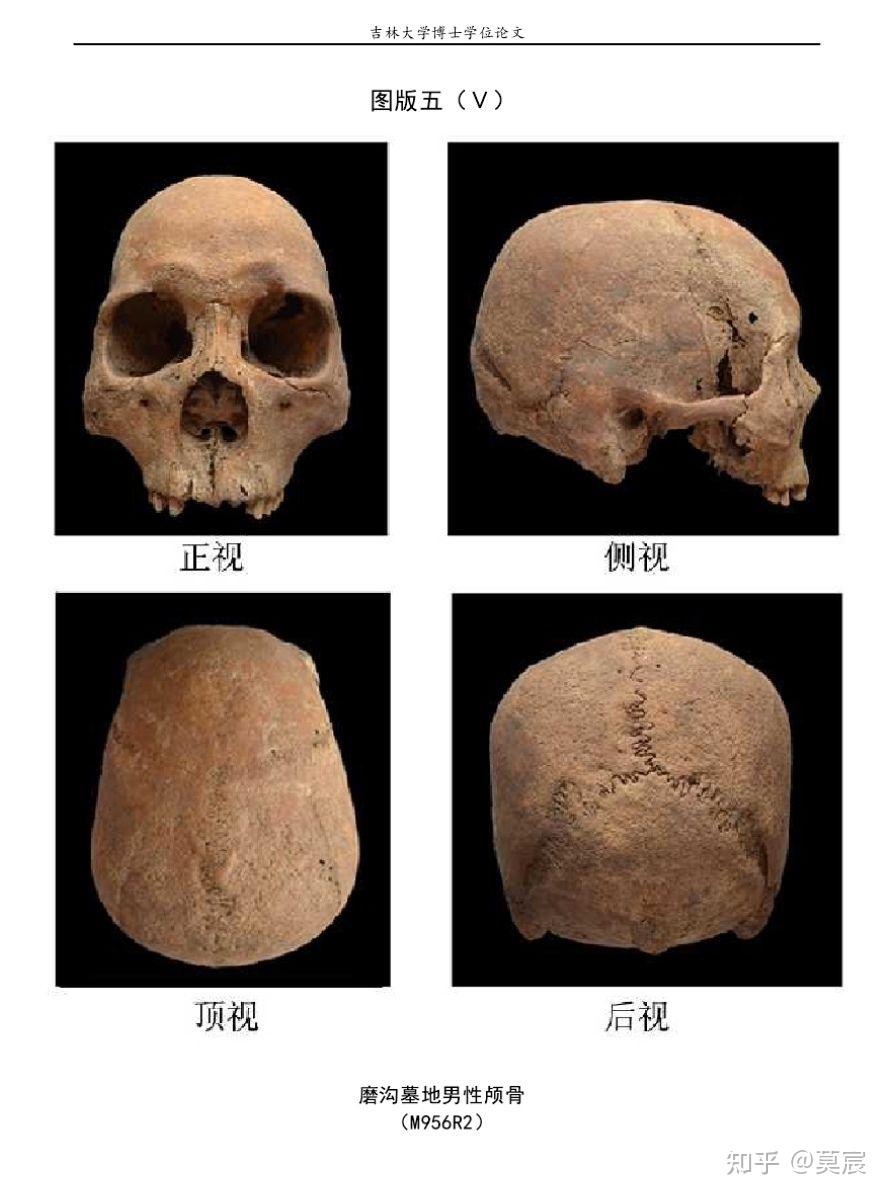 为什么粗略划分的世界三大人种的头部骨骼比较中,实物图一般都显示