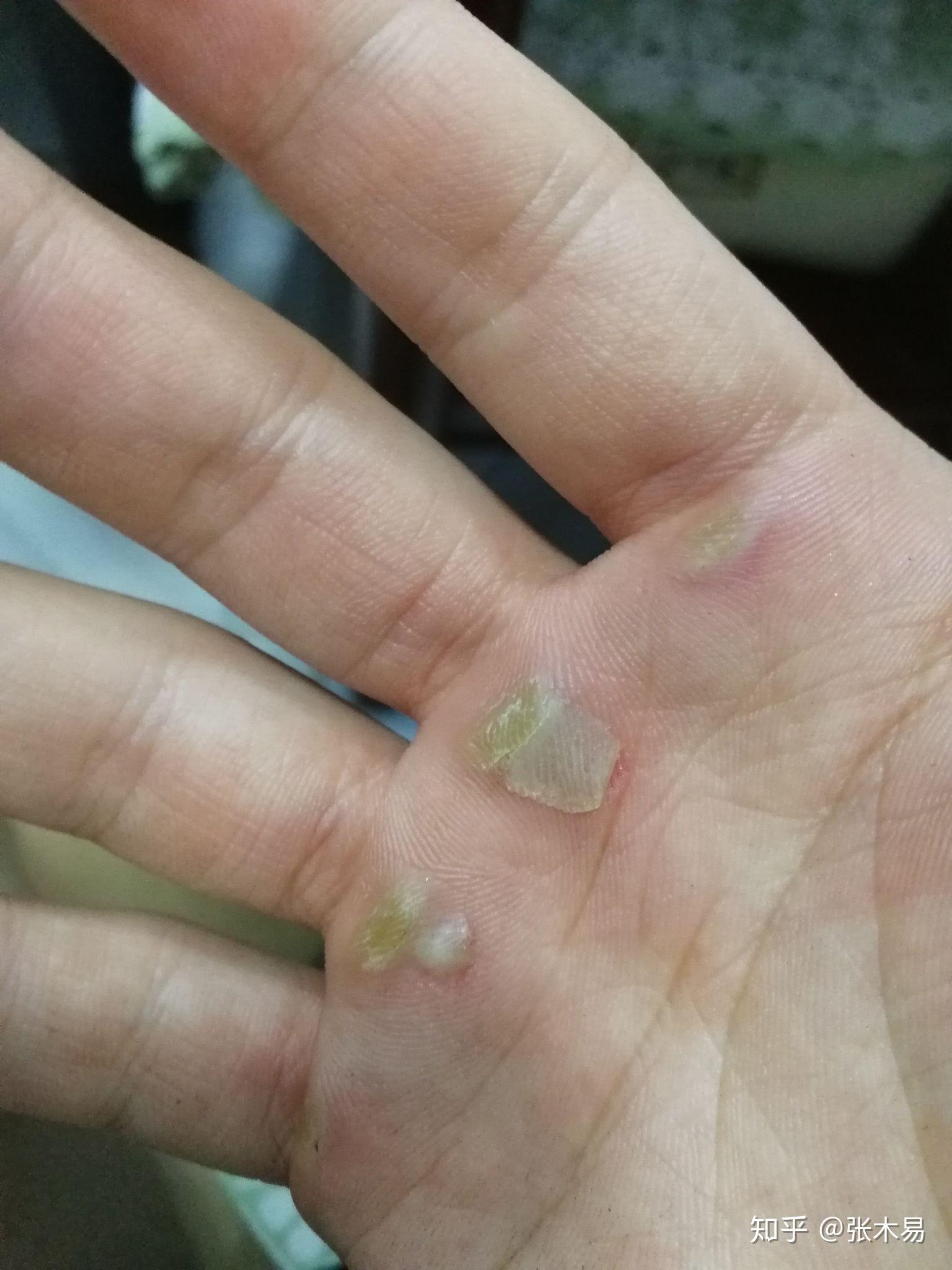 做引体向上时怎样避免双手起茧