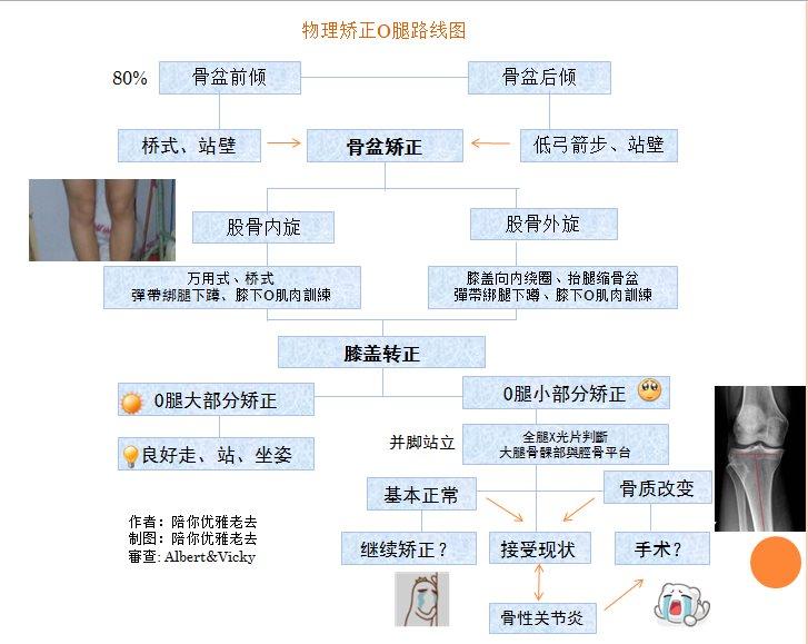 物理矫正o型腿大汇总可物理矫正改善的o型腿