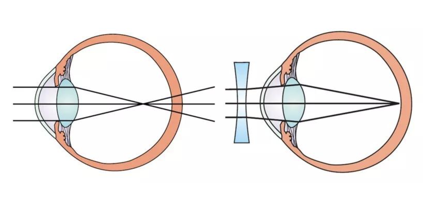 其中一个重要的章节就是《眼球成像的物理光学基础》,除了人眼与照相