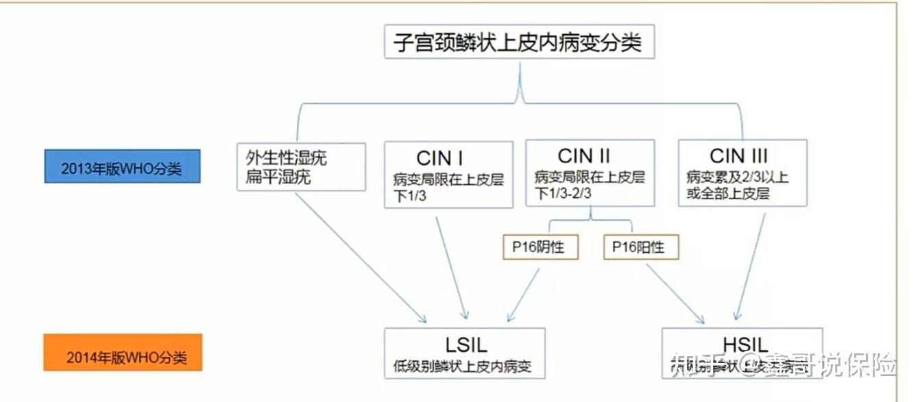 cin分級如圖,是子宮頸鱗狀上皮病變的的分類,2013年之前是用cin(1,2,3