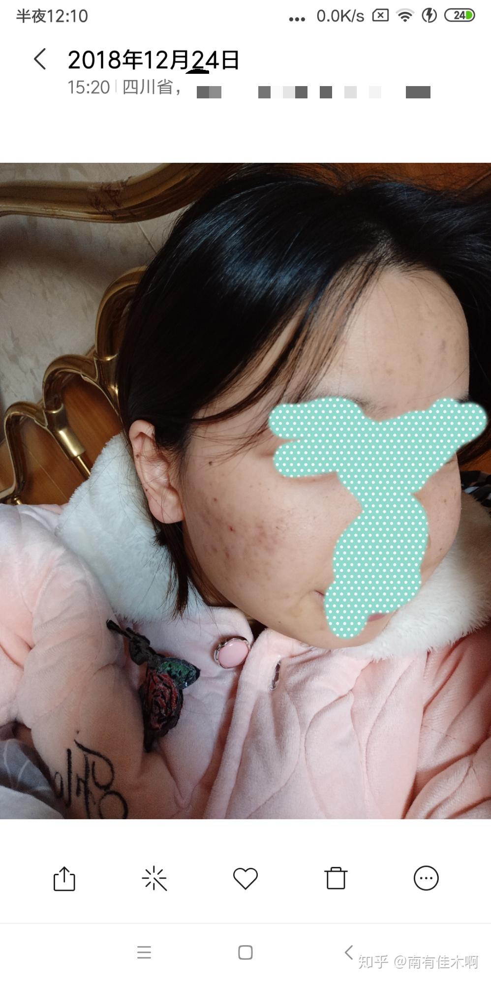 怎么才能不长闭口 v2-d2141a837c7fcfb0bb228903d3c1c128_r.jpg