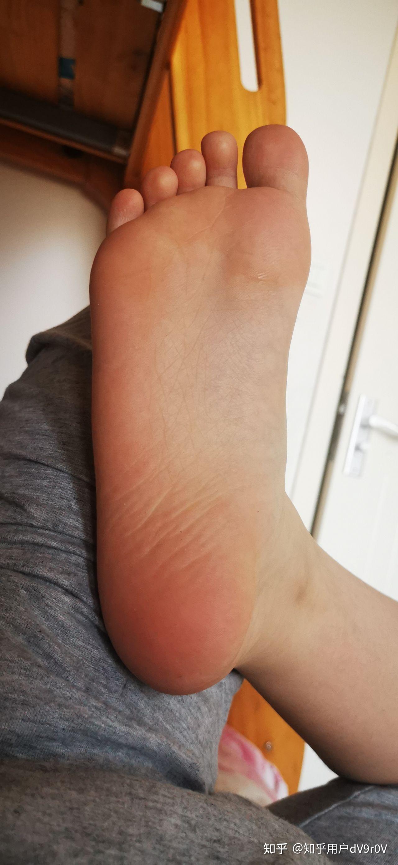 男孩脚底照片有什么问题吗