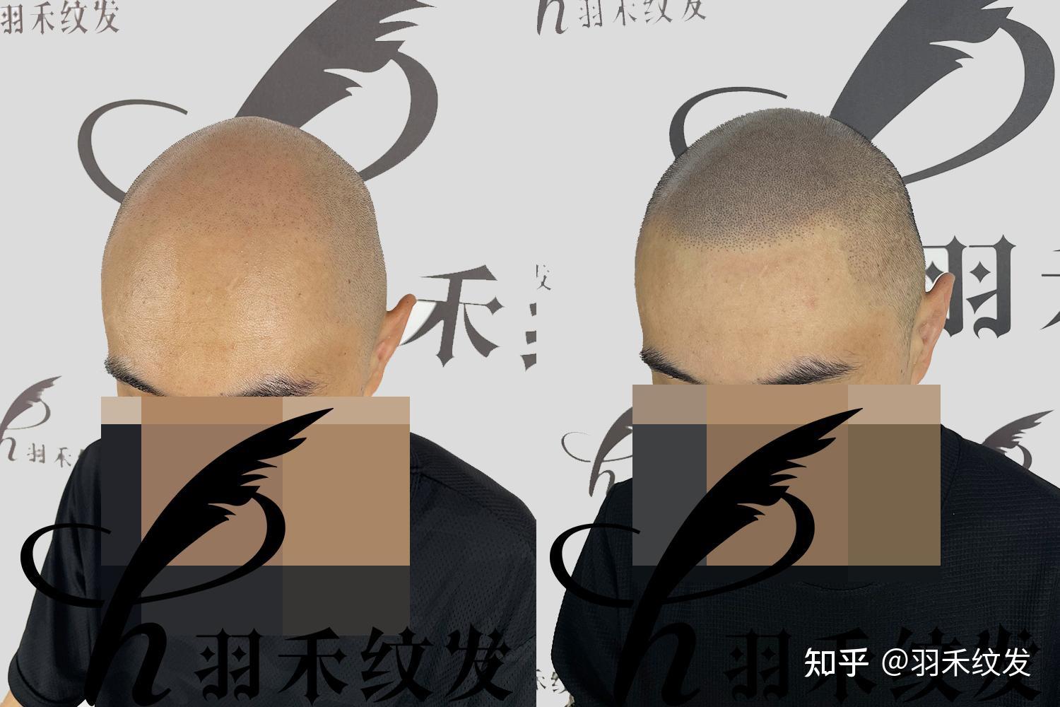 纹发后为什么视觉上有立体感? - 知乎