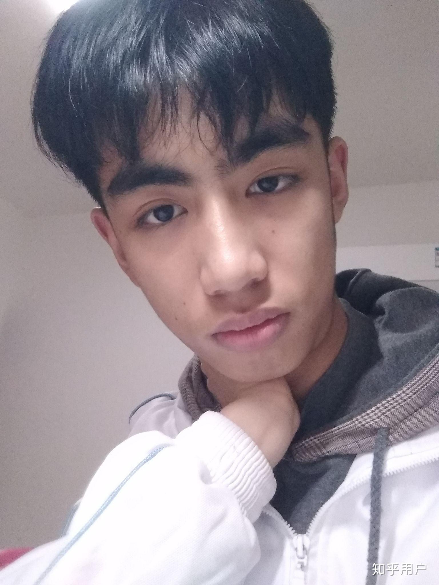 口呼吸改为鼻呼吸后面容也能改善吗14岁