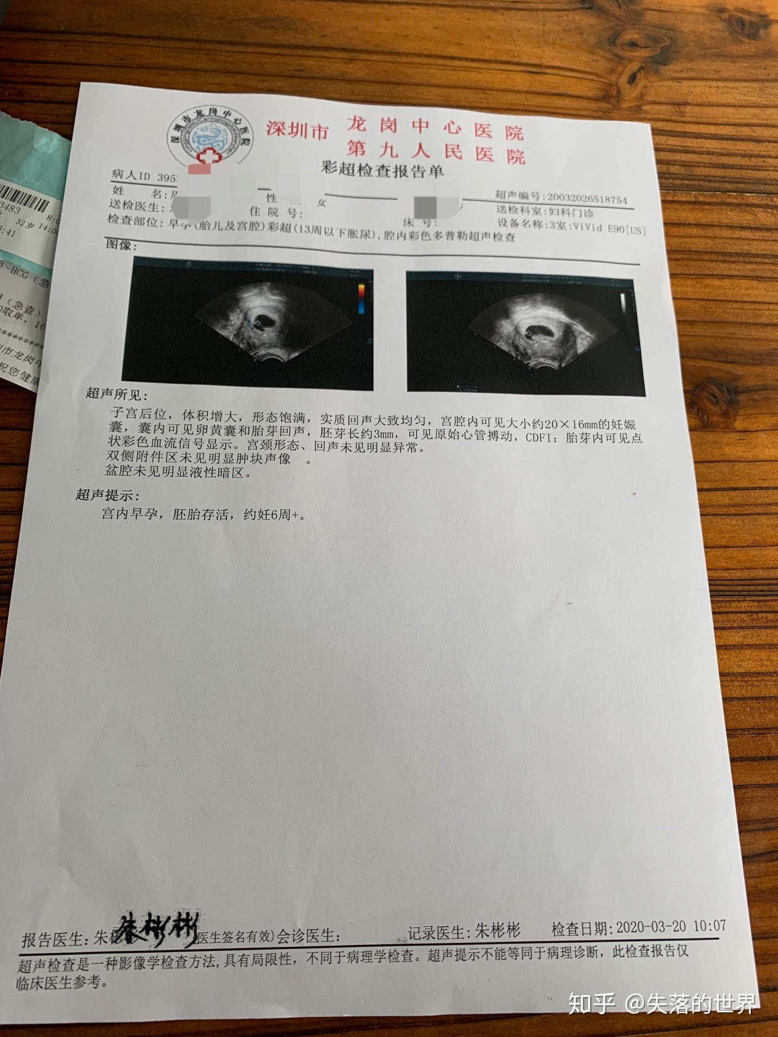 v2-d28a4dded52099c964239484faed8ae4_r.jpg