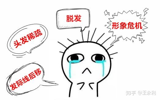 头顶m角难看 听听过来人怎么说 知乎