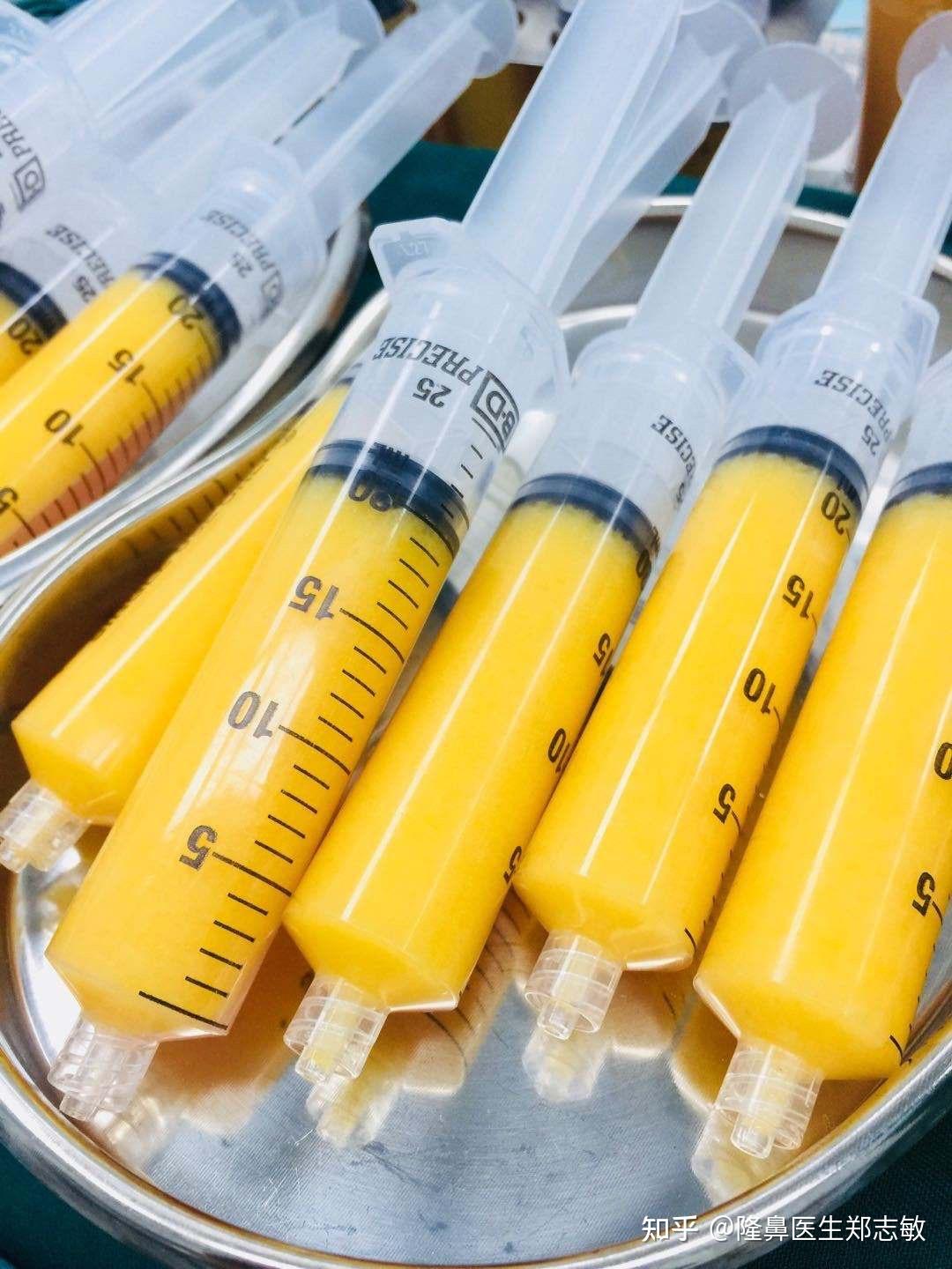 弗缦胶原蛋白填充泪沟能维持6-12个月,且弗缦填充泪沟成效好-注射在骨膜上不易移位,附价格