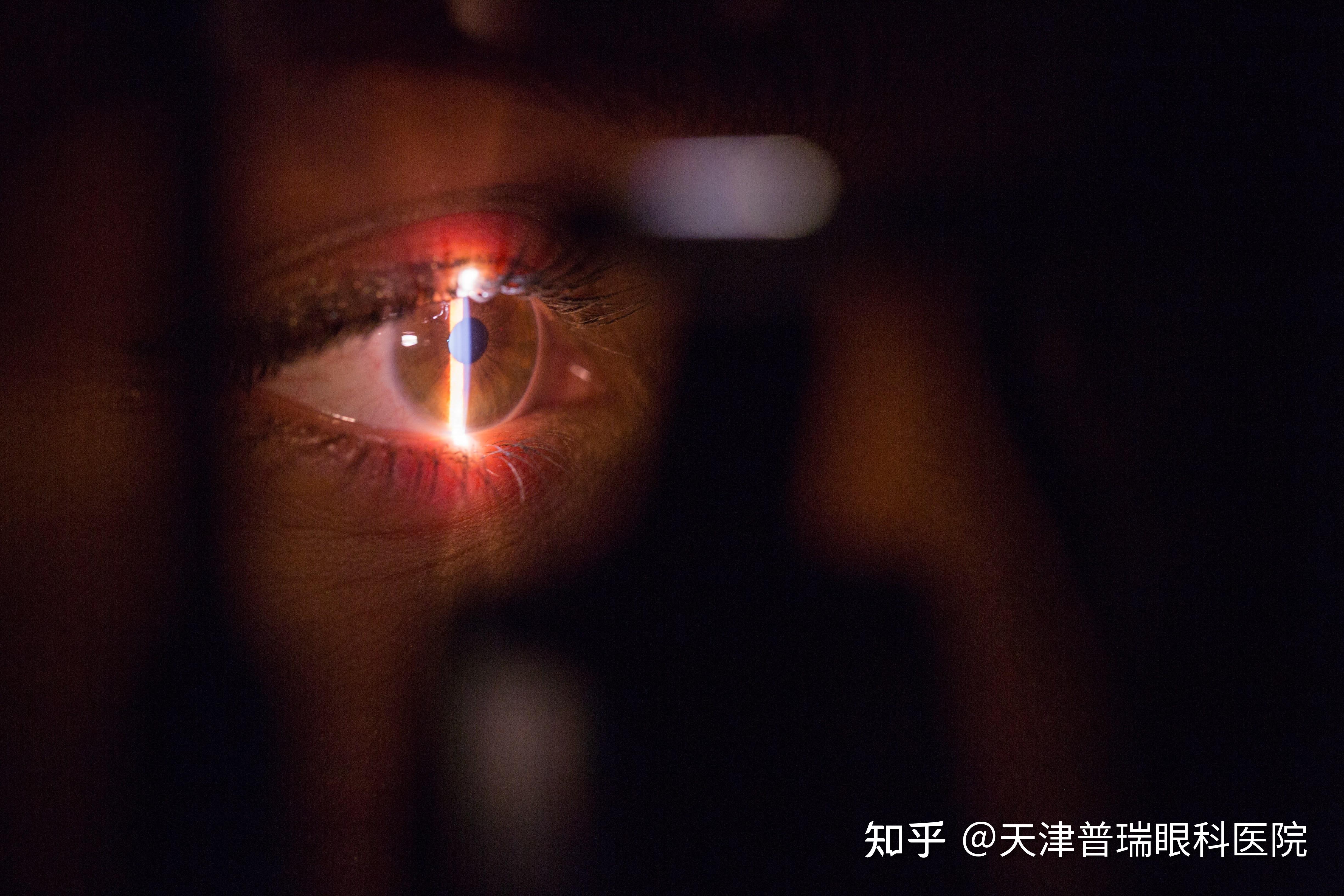 天津市眼科医院--什么是全飞秒激光角膜屈光手术？