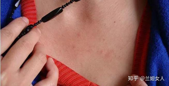 穿了没几次里面就堆积大量的细菌和螨虫,久而久之我们的皮肤会发痒