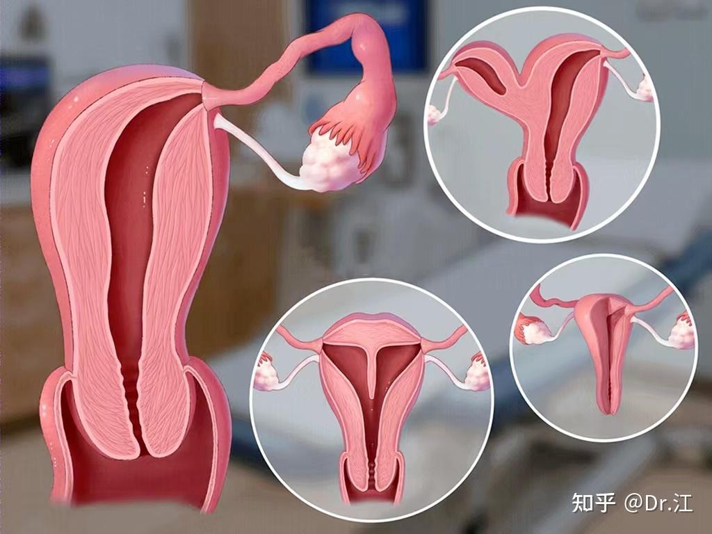 【医路同行】（二十一）四维子宫输卵管超声造影术_宫腔