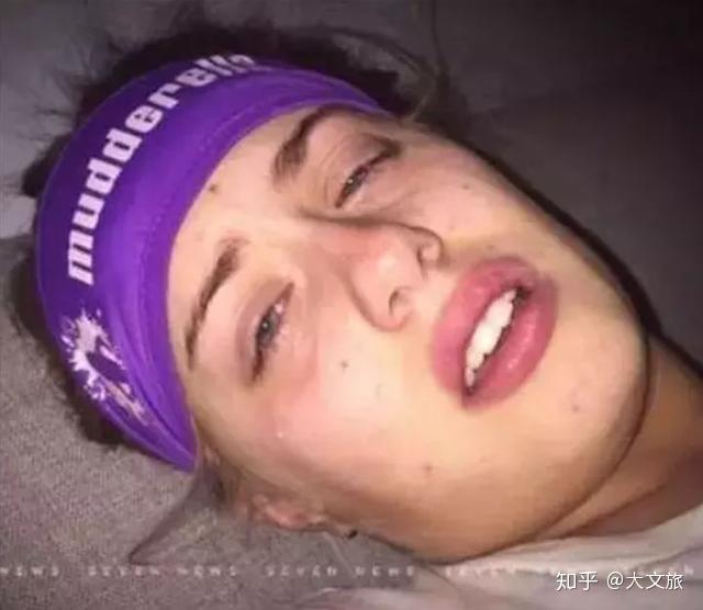 但当她从斐济回到澳洲的时候,就出现了高烧,乏力,恶心,呕吐的症状.