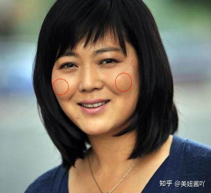 颧骨高用什么办法可以改善啊? - 知乎