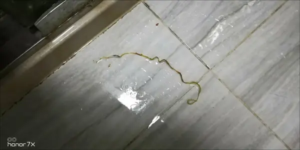 一只寄生虫从内科到传染到防疫站到疾控中心被难倒了