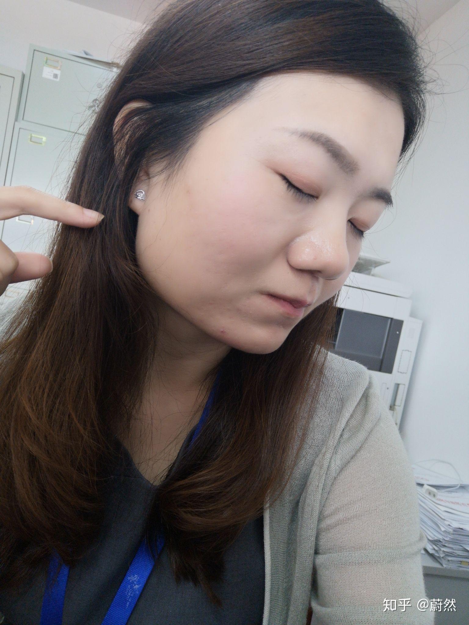 因为方脸 脸宽 下颌骨肥大而自卑怎么办 该不该削骨? - 知乎