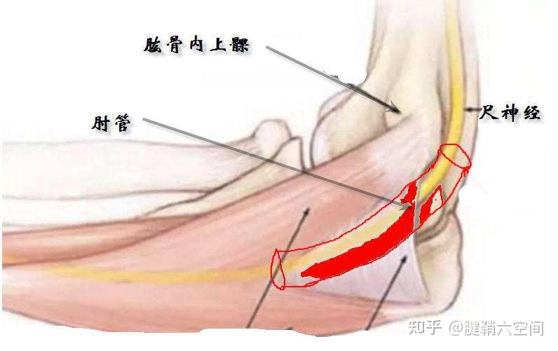 肘管综合征解剖图图片