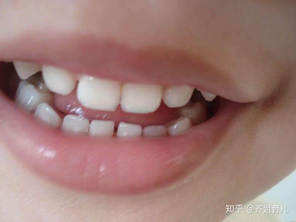 这4个坏习惯影响孩子外貌,不想让娃越长越丑,就快帮他纠正