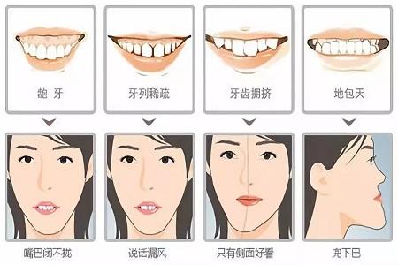 牙齿脸型变化图图片