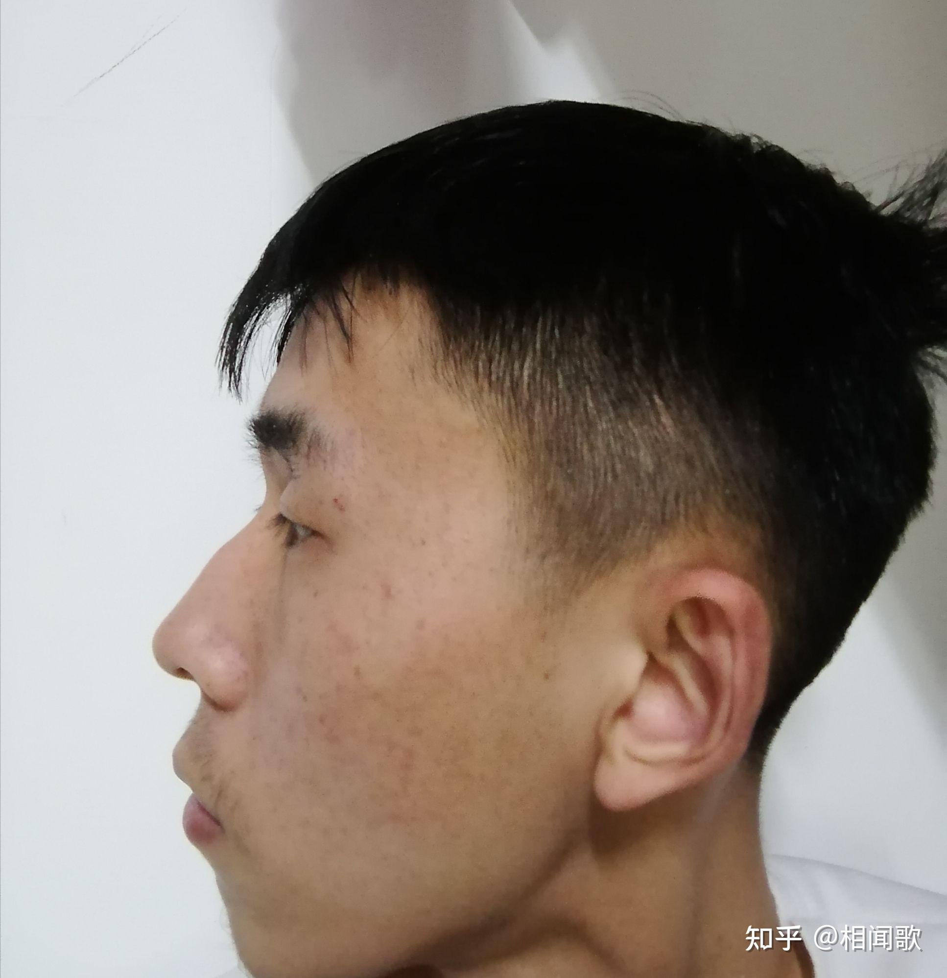 鼻子高但是山根低是什么样? - 知乎