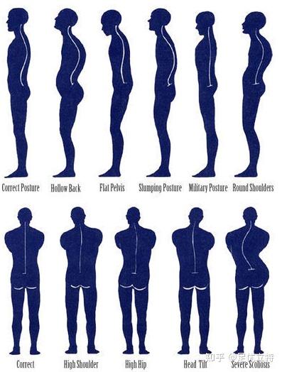 身体姿势大检查，快来测试一下！ - 知乎